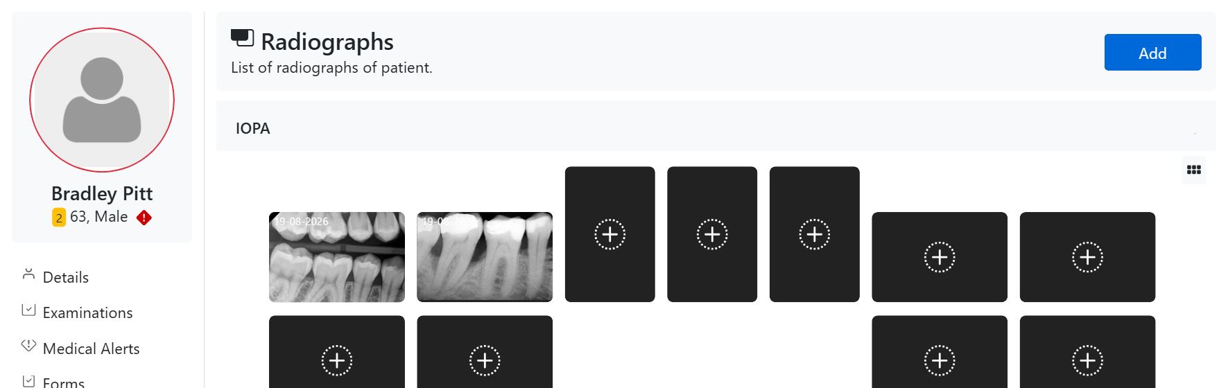 Patient dental radiographs organised by type in CAPS28 practice management software